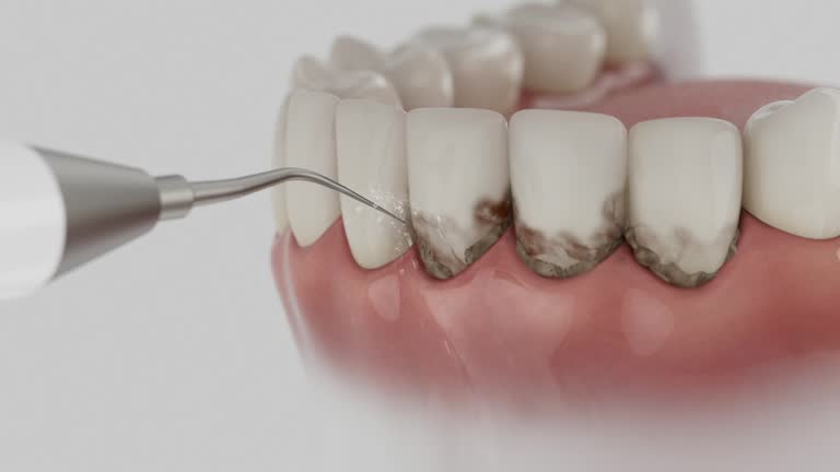 Reliable Tooth Extraction contractor in Cross Plains, TX by Smile Center Dentistry